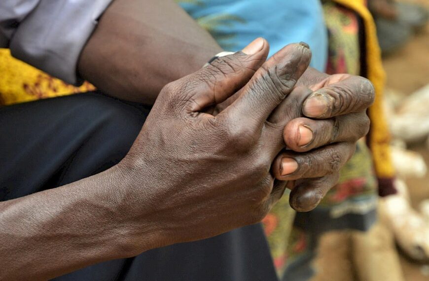 Tanzania on Track to Meet WHO Goal to End Leprosy by 2030