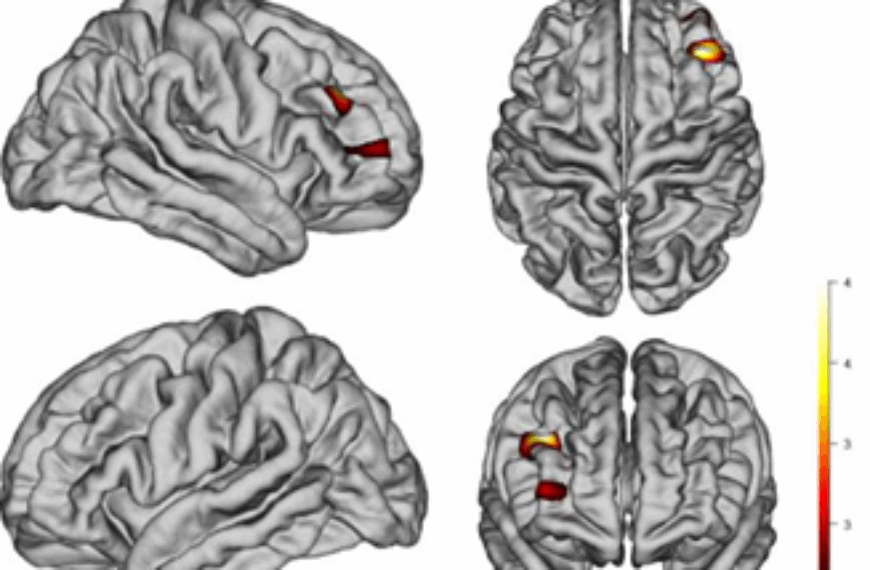 LONG-TERM HEAVY CANNABIS USE LINKED TO THINNING IN FRONTAL BRAIN REGION